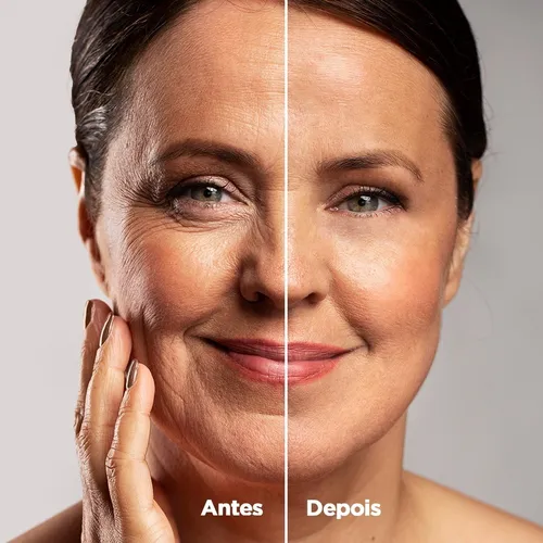 Antes e depois Rosa Oriental